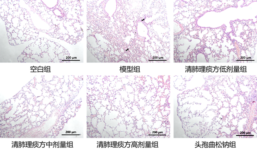 科研管理 科研资讯     其次,观察小鼠肺组织病理切片he染色结果显示